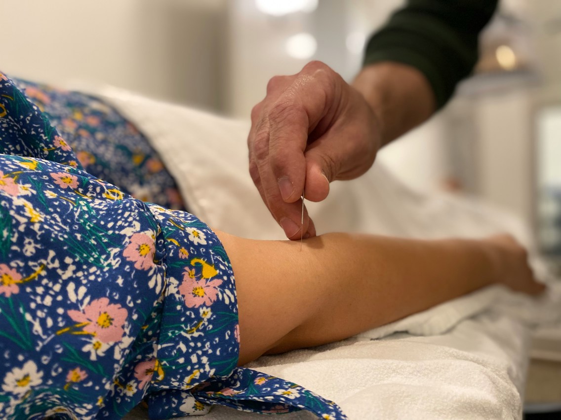 Mannlig hånd stikker akupunkturnål i armen på en kvinnelig pasient