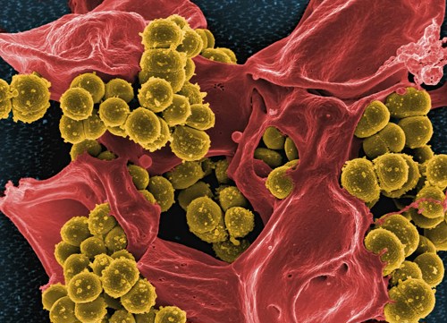 Antibiotikaresistens: ny metode kan oppdage farlige infeksjoner før legene 